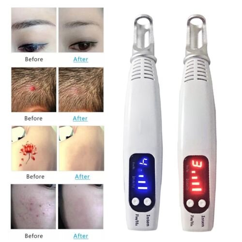 Laser Neatcell portátil