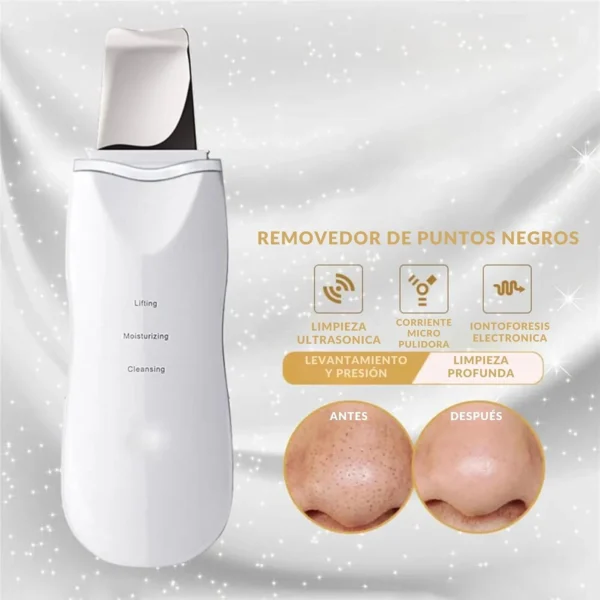 Paleta Ultrasónica portátil