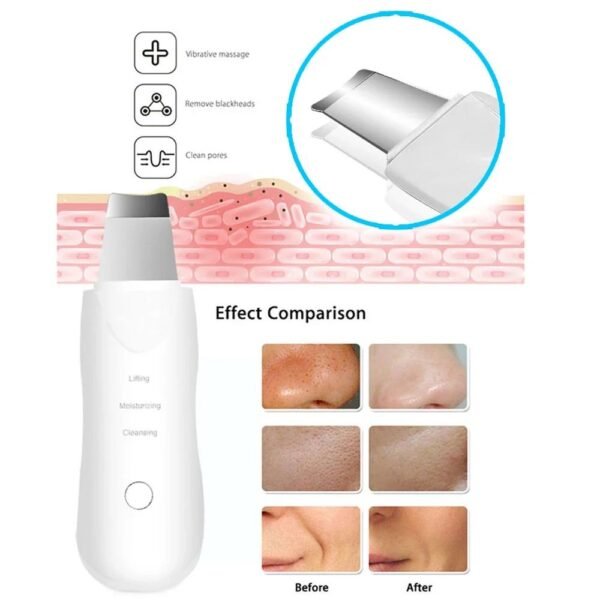 Paleta Ultrasónica portátil