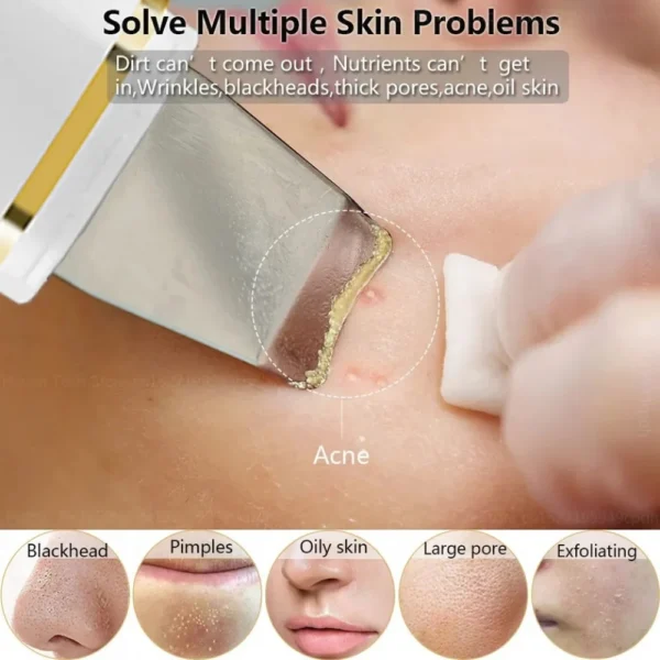 Paleta Ultrasónica portátil
